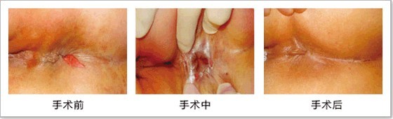 130-1210101H14YQ.jpg