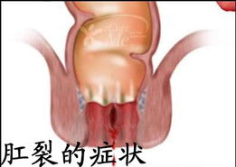 c543edae5cf93e05-879e67925ea837f6-b736108c6e9fbb3ed2f8630238336597.jpg