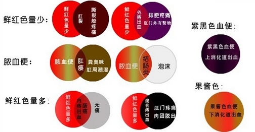 便血3.jpg