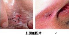 QQ截图20140827152340.jpg