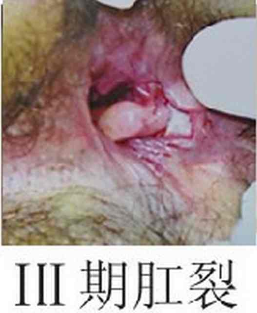东大20120gc.jpg