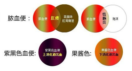 点击咨询