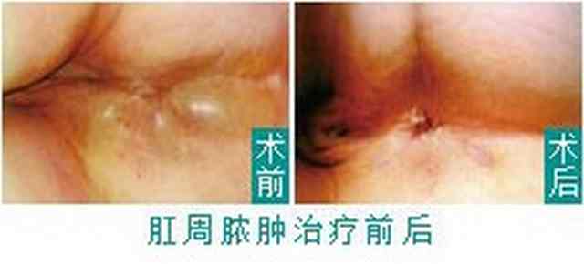 东大22120gc.jpg