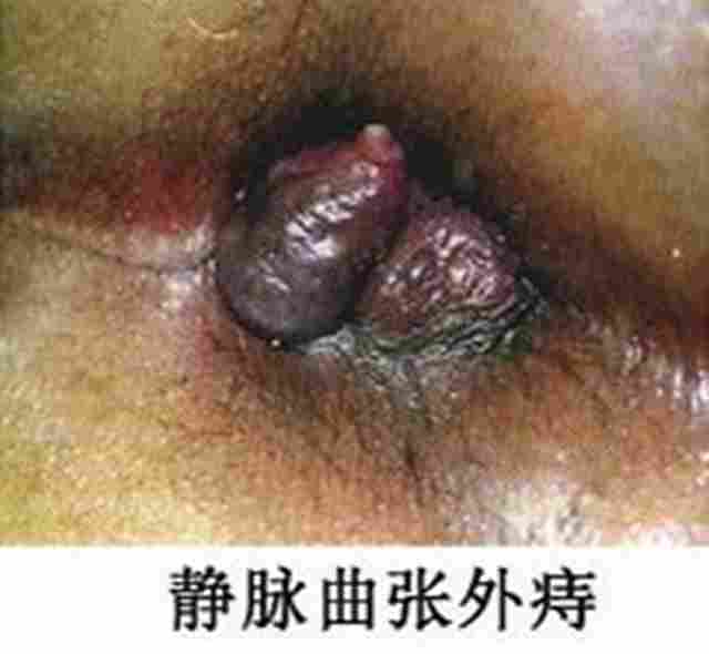 IMG_11东大.jpg