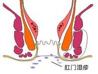 肛门潮湿1.jpg