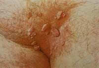 20110301031100642.jpg