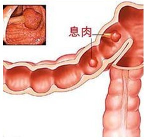201303091324357840.jpg